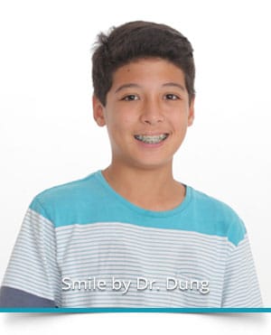 Adolescent Treatment Mililani HI | Mililani Orthodontics